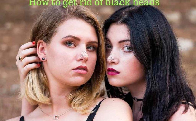How to get rid of blackheads Naturally